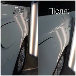 Dent Service
