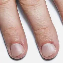 Fade 3b — Харьков