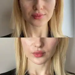 Марина Тенетюх - Миколаїв