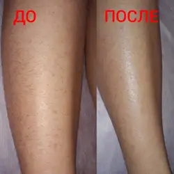 Веста майстер депіляції — Днепр