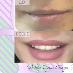 Ірина Башура