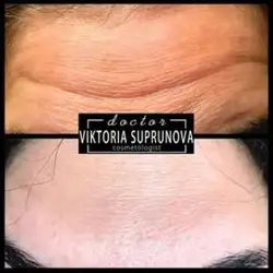 Вікторія Супрунова