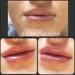 Косметолог Віолетта