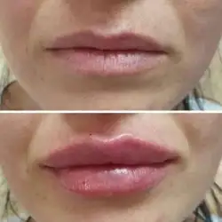 Єкатерина Биткова