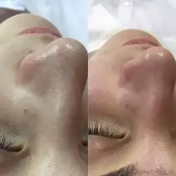 Діана Інютина