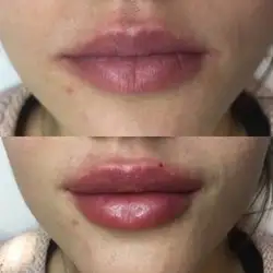 Діана Мес'янінова
