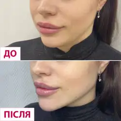 Лазерхауз - Ужгород