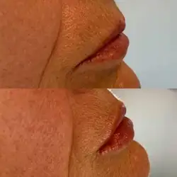 Luxederm