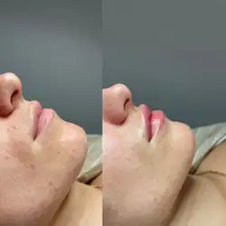Аліна Демьянкова