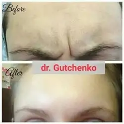 Катерина Гутченко Косметолог