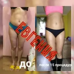 Євгенія Голова масажист