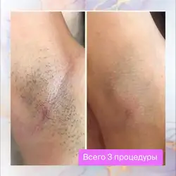 Аліна Іванова — Днепр