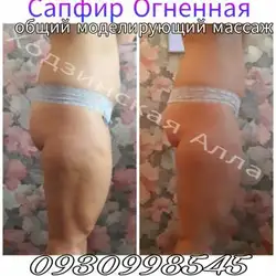 Алла Ходзинская