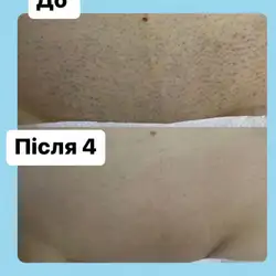 Анастасія Ільчук