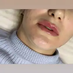 Василина Молодан косметолог