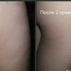 Антоніна Третьякова масажист