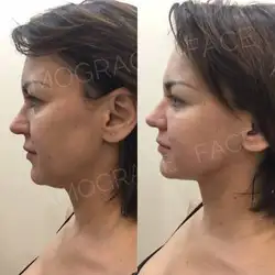 Amograce